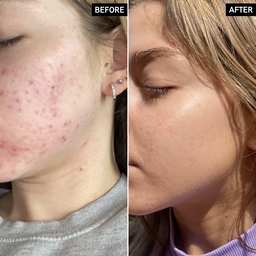 The INKEY Niacinamide