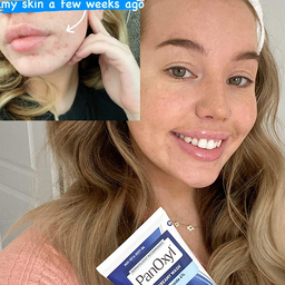 PanOxyl Acne Creamy Wash Benzoyl Peroxide 4% Daily Control 170g