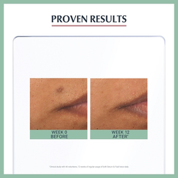 Eucerin ProACNE Solution Triple Effect Serum 40ml