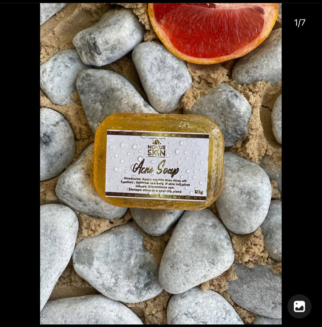 Acne soap