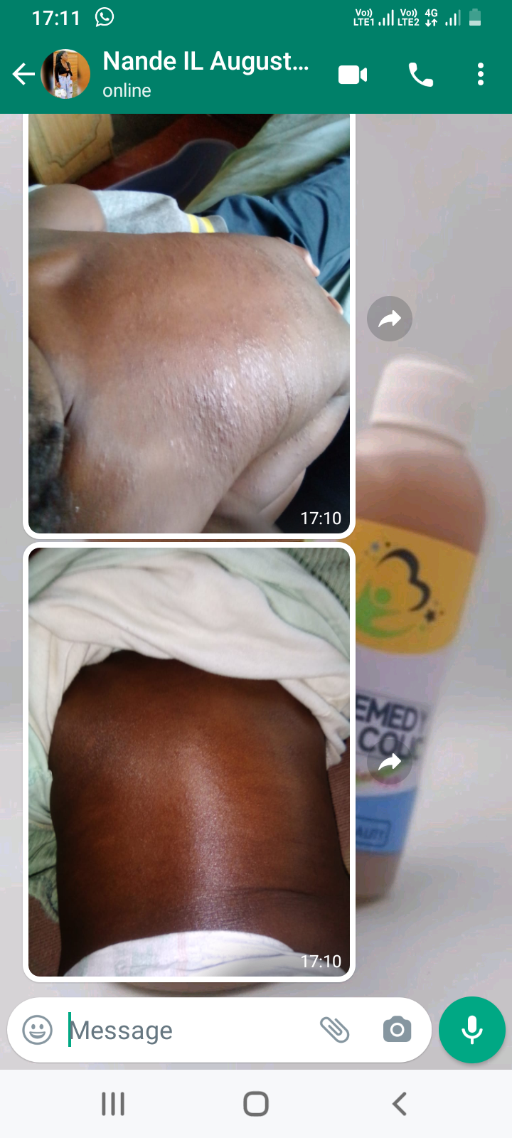 IL Remedy For Colic (Iyeza LePleyiti) _7