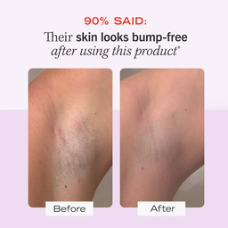 First Aid Beauty Ingrown Hair Pads with BHA & AHA