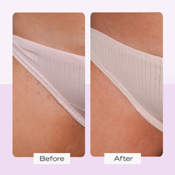 First Aid Beauty Ingrown Hair Pads with BHA & AHA