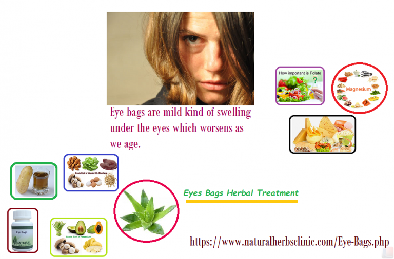 7 Home Remedies for Eye Bags