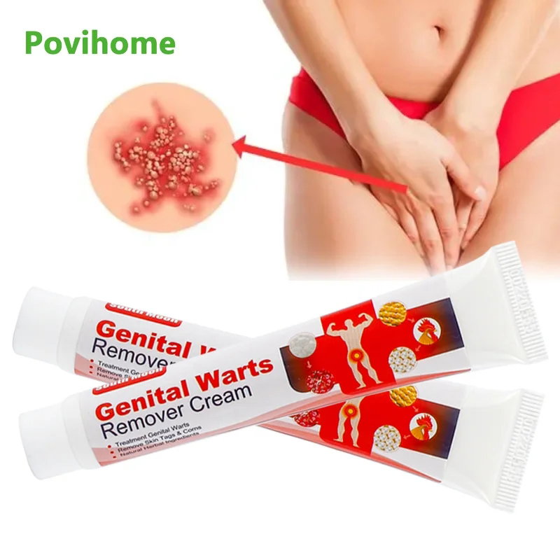 Genital infection/rash/wart removal cream_0