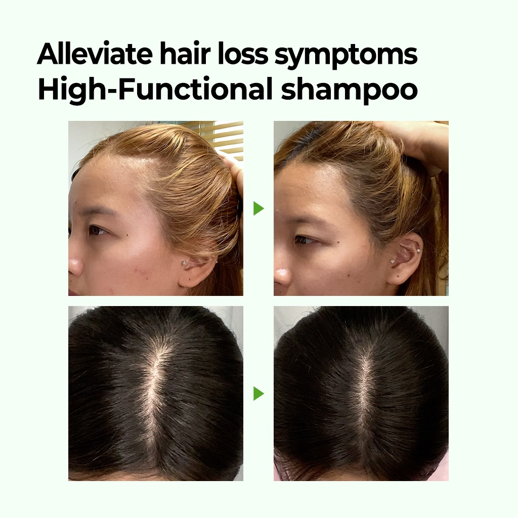 Some By Mi Cica Peptide Anti Hair Loss Derma Scalp Shampoo 285ml_1