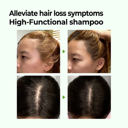 Some By Mi Cica Peptide Anti Hair Loss Derma Scalp Shampoo 285ml