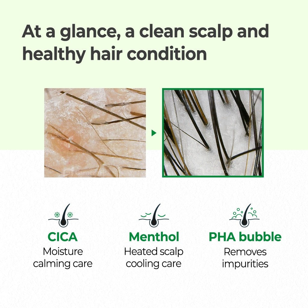 Some By Mi Cica Peptide Anti Hair Loss Derma Scalp Shampoo 285ml_4