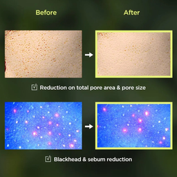 Anua Heartleaf 77% Clear Pad 70 pads