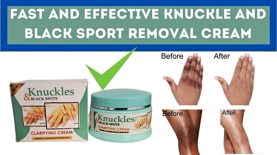 Knuckles Dark Spot Remover