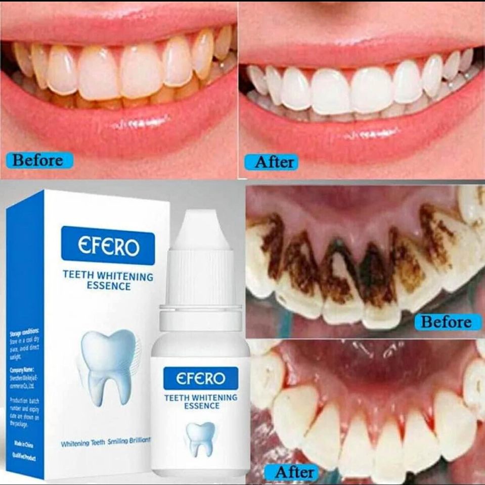 Teeth Whitening Liquid  _1