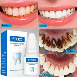 Teeth Whitening Liquid  