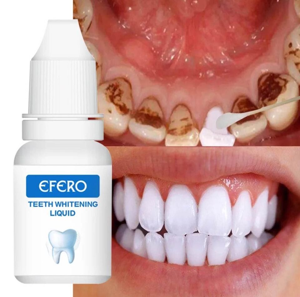 Teeth Whitening Liquid  _0