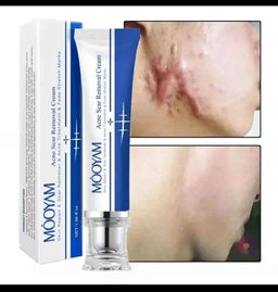 Scar Removal Cream