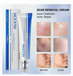 Scar Removal Cream