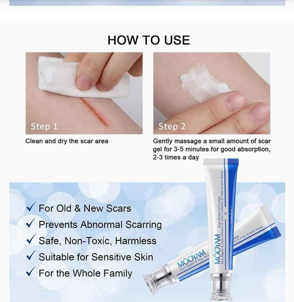 Scar Removal Cream_2