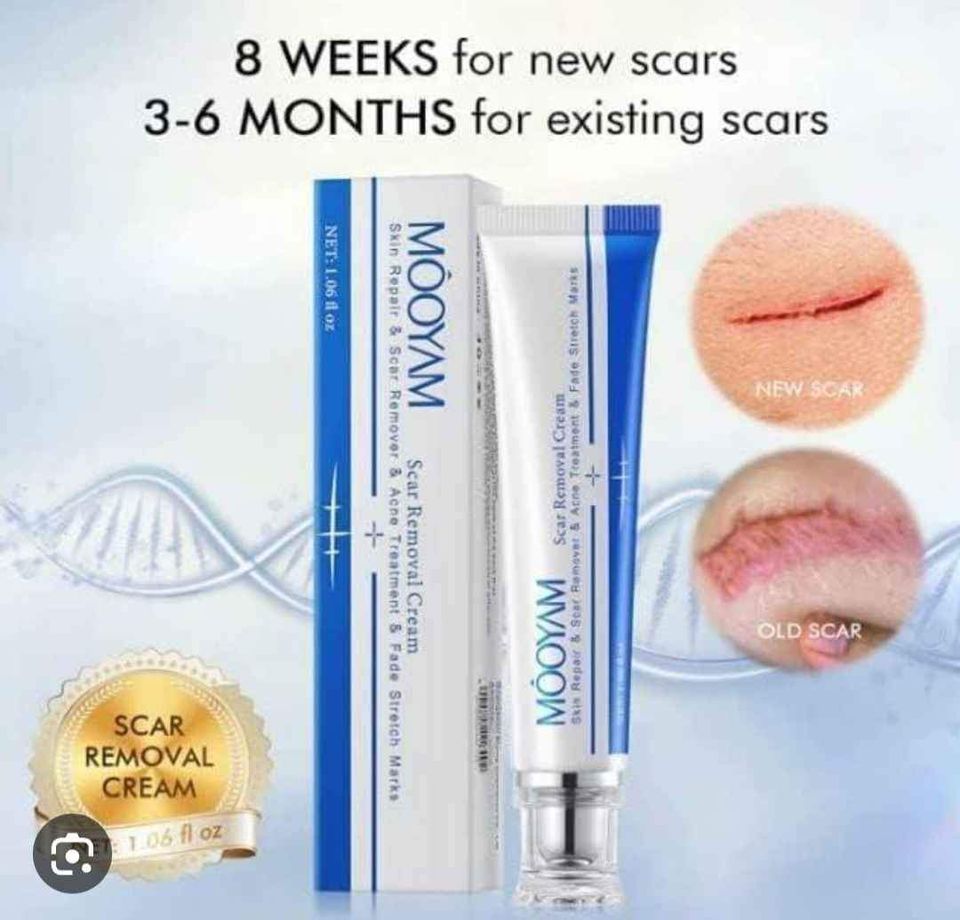 Scar Removal Cream_3