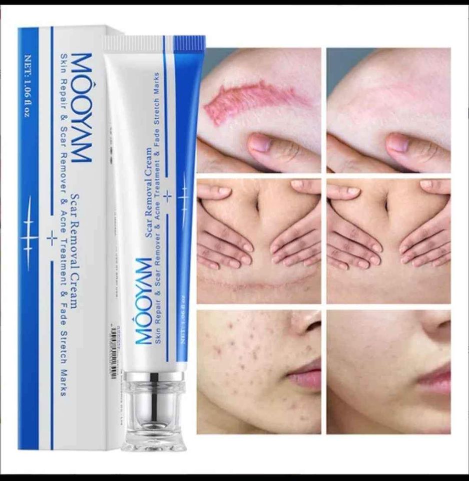 Scar Removal Cream_5