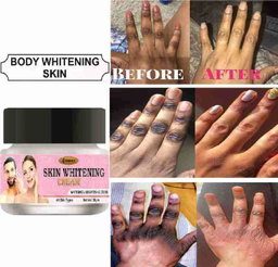  Face & Body Whitening Cream