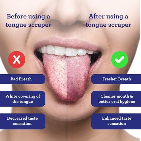 SPOON SHAPED STAINLESS STEEL TONGUE SCRAPER (2-PACK)_2