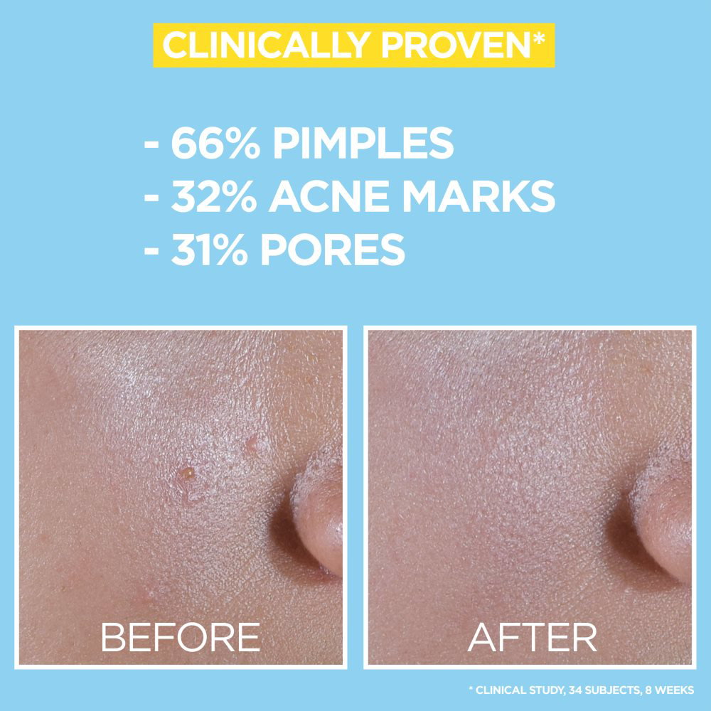 Garnier BHA + NIACINAMIDE DAILY UV_2