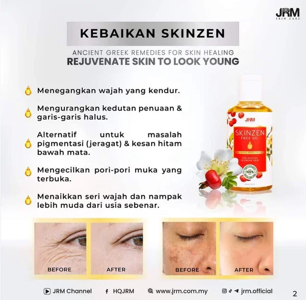 Skinzen Face Oil by JRM Bonda Rozita_3