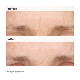The Ordinary Retinol 0.2% Emulsion 15ml