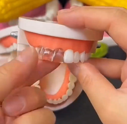 Dr. Smile Tooth Replacement Kit™