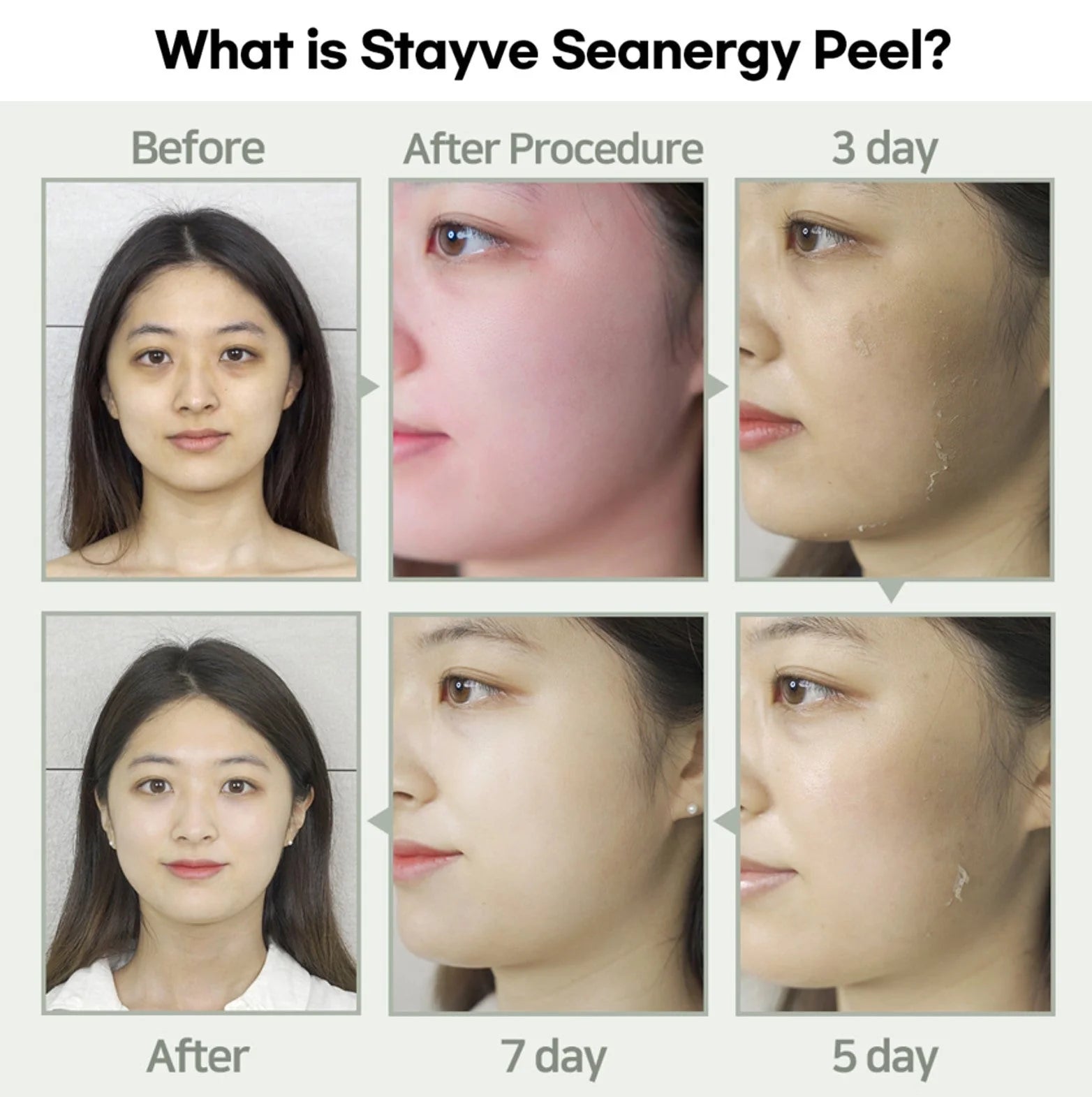 Seanergy Peel Ampoule Box_2
