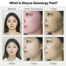 Seanergy Peel Ampoule Box