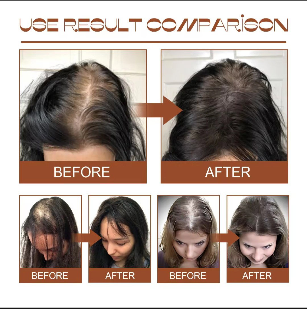 Batana Oil Hair Mask _3