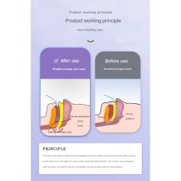 Mouthtape 