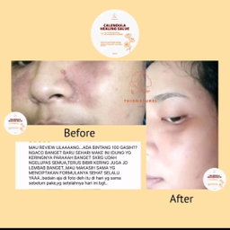 CALENDULA BALM 