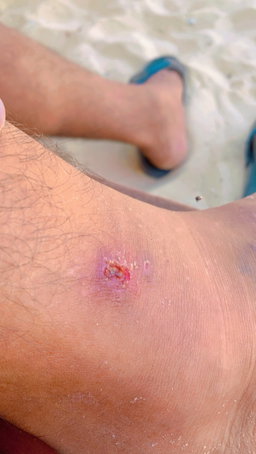 Children's treatment