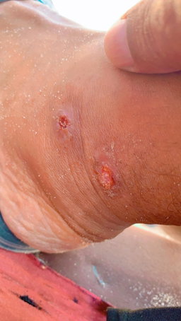 Children's treatment