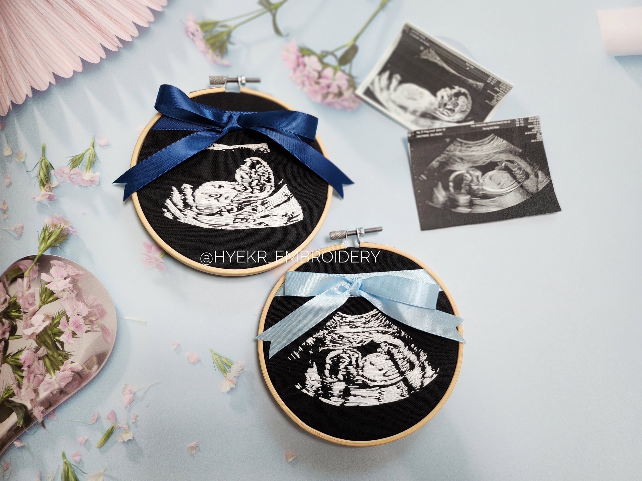 Classic Ultrasound Embroidery Hoop_6