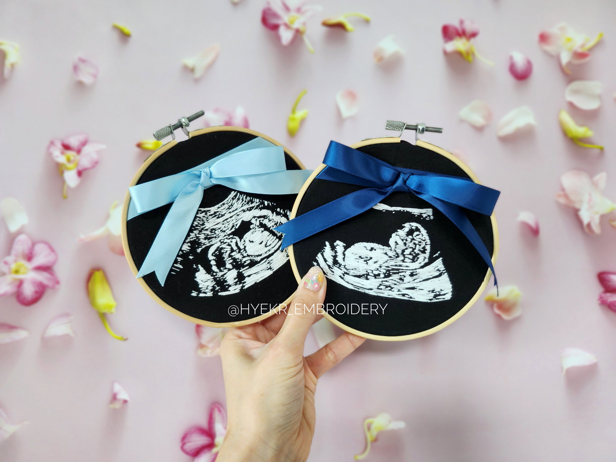 Classic Ultrasound Embroidery Hoop_1