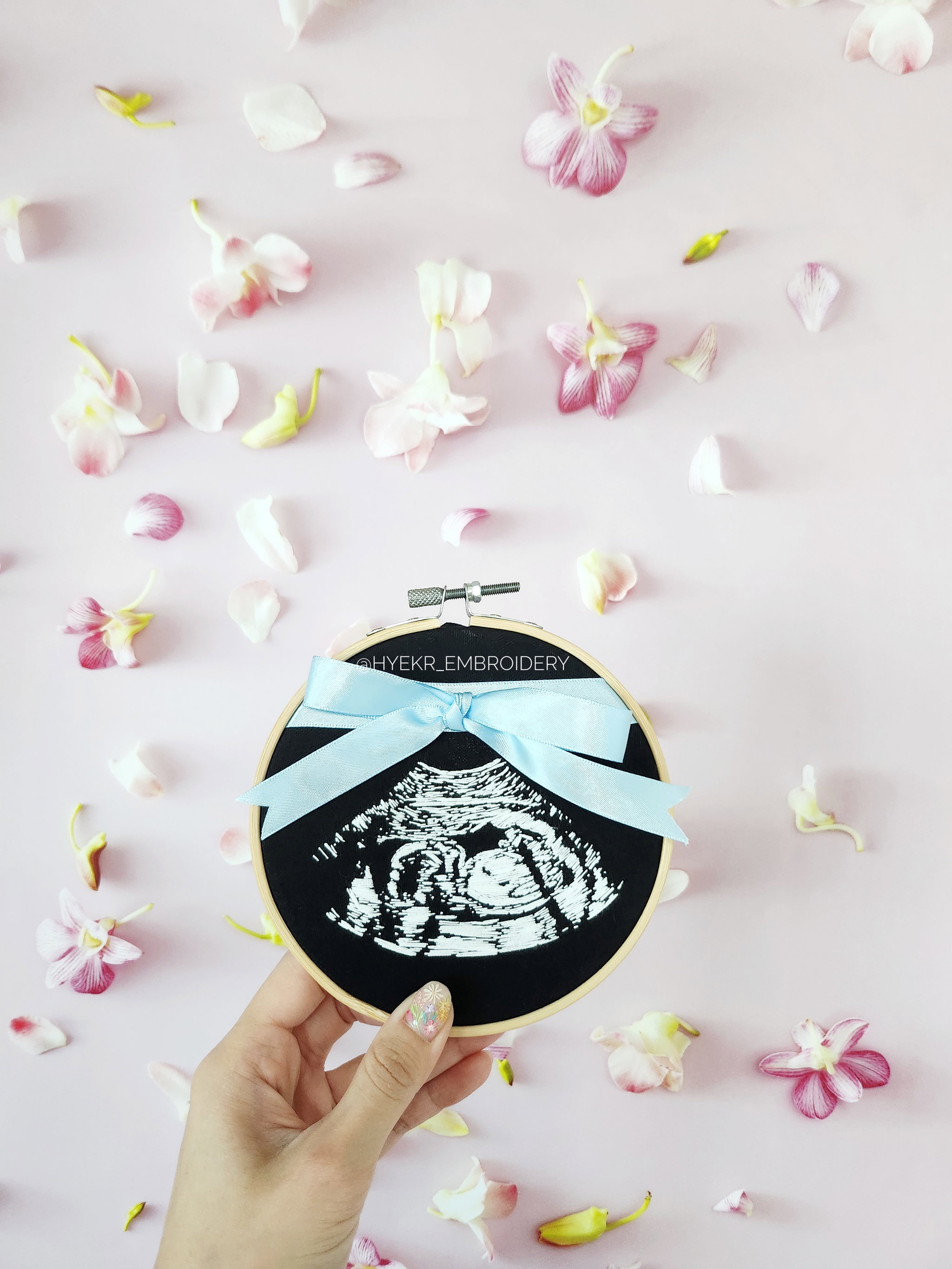 Classic Ultrasound Embroidery Hoop_5