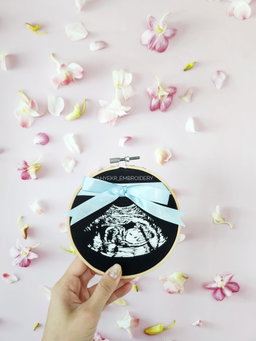 Classic Ultrasound Embroidery Hoop