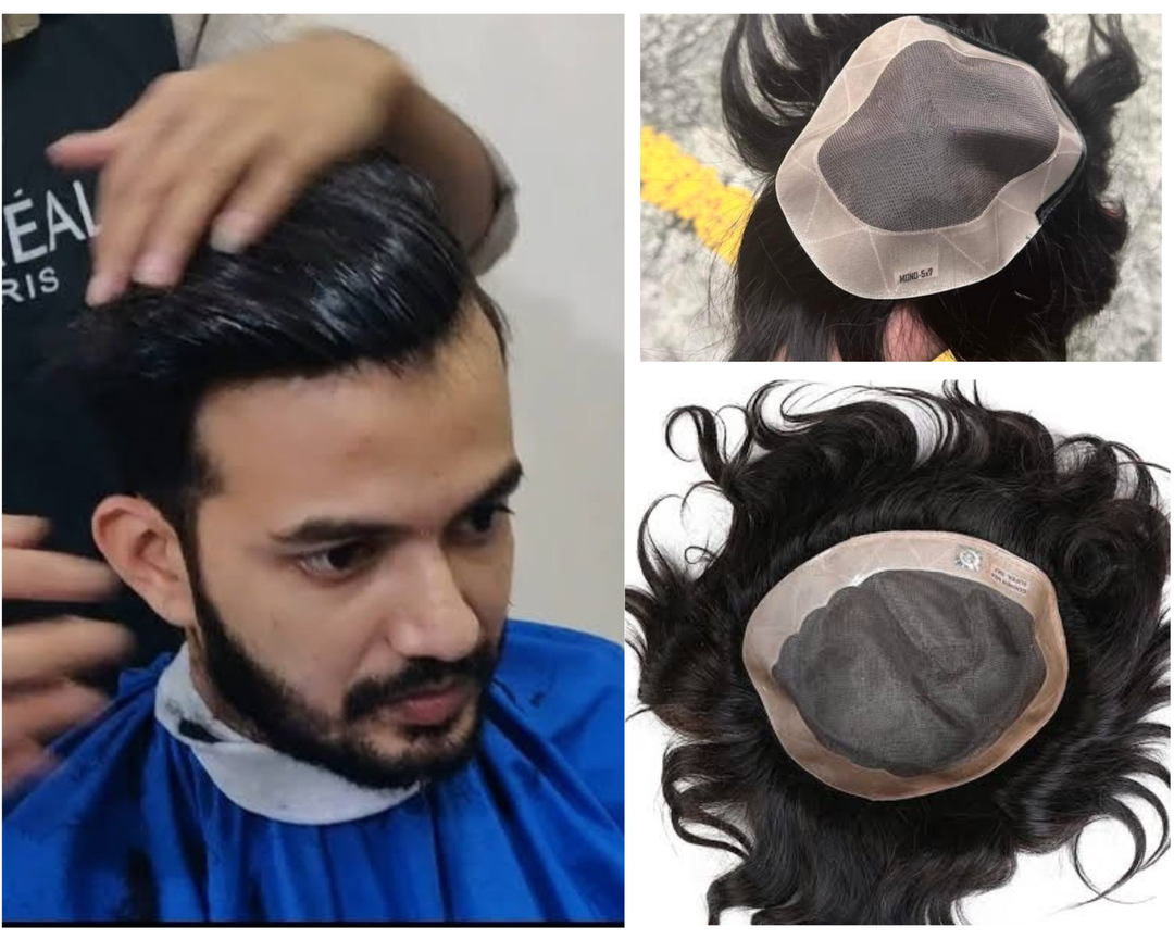 Mono Hair system