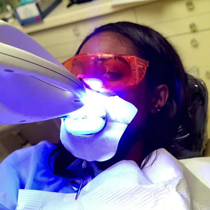 Tooth Whitening