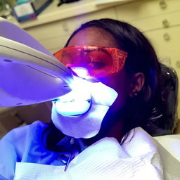 Tooth Whitening
