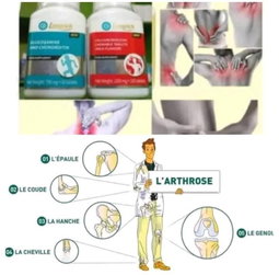 Arthro et calcium de longrich 