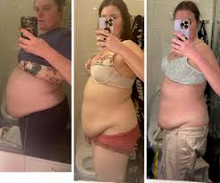 5MG Injectable Weight Loss Treatments (Semiglutide)