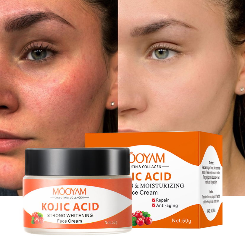 Kojic acid face cream _1