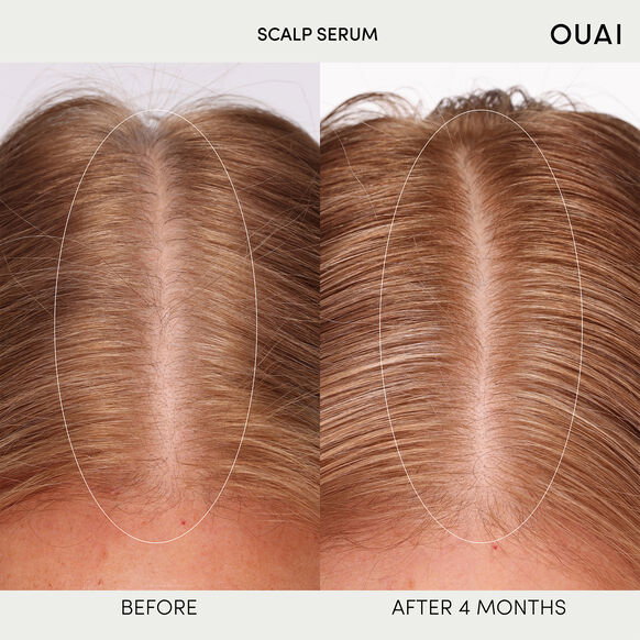 OUAI Hydrating Scalp Serum for Healthy, Fuller Looking Hair_1