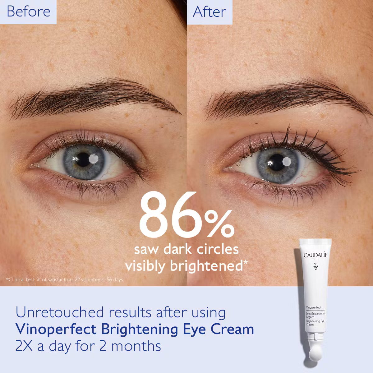 CAUDALIE Vinoperfect Dark Circle Brightening Eye Cream with Niacinamide_1