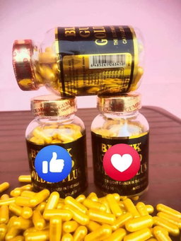 Items