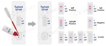 Typhoid Strip