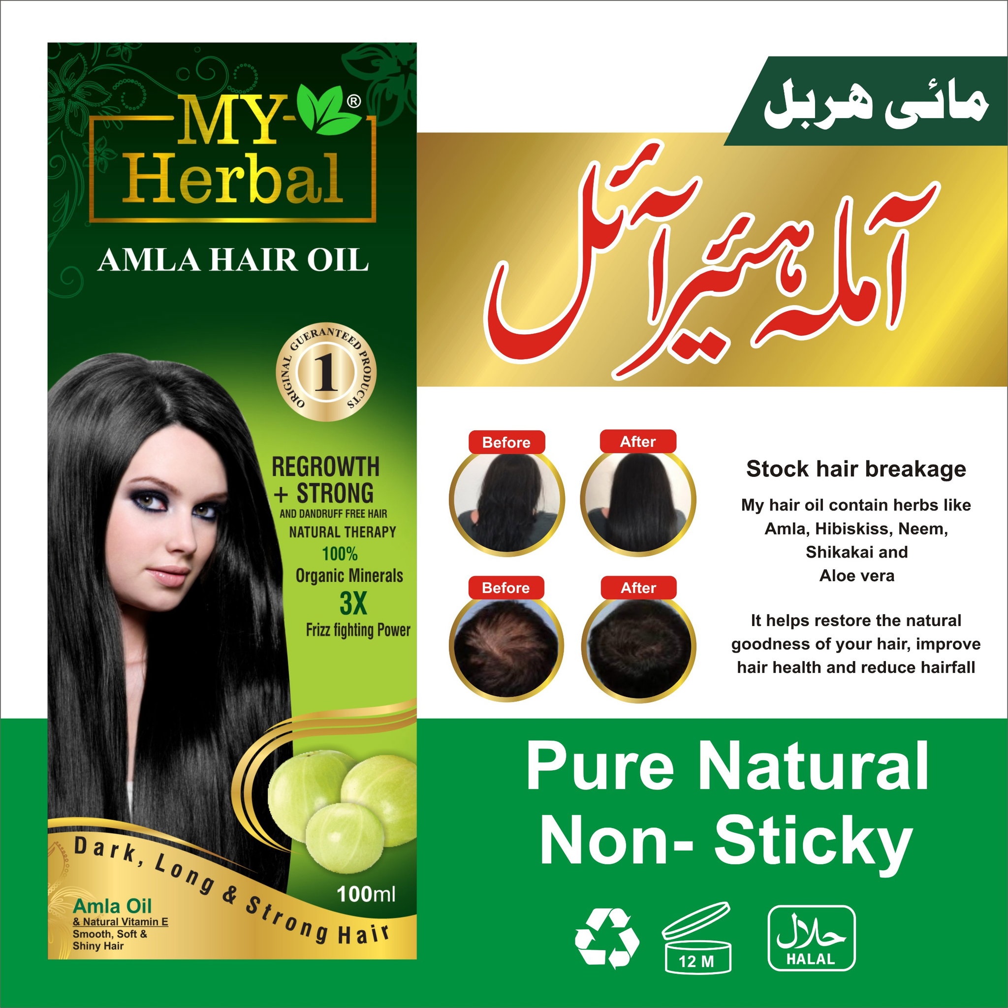 My Herbal Amla Oil_6